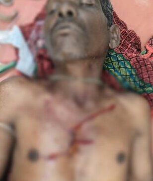 महुआ बीनने गए ग्रामीणों पर भालू ने किया हमला, एक की हालत गंभीर